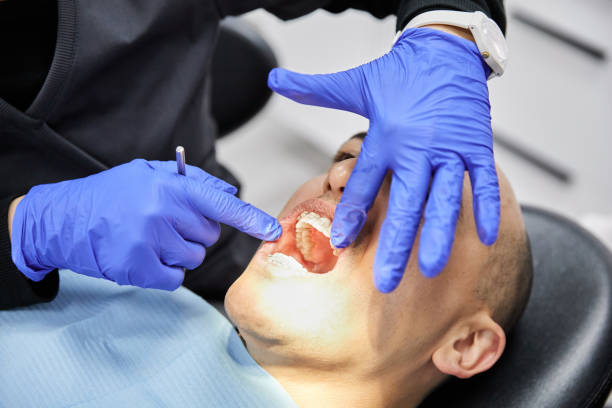Best Broken or Chipped Tooth Repair in Key West, FL